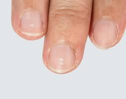 the white spots on your nails do not