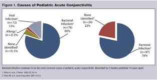 Differentiating Bacterial Conjunctivitis From Allergic And