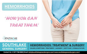 hemorrhoids how you can treat them