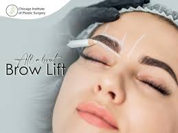 brow lift for a youthful appearance