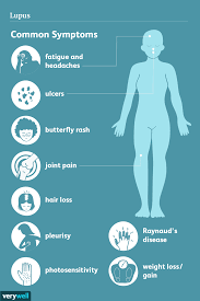 lupus signs symptoms and complications