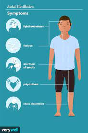 atrial fibrillation signs symptoms