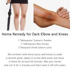 i have dark elbows knees how to get rid