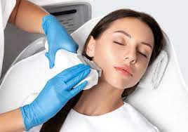 permanent laser hair removal process