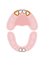 Baby Teeth Chart What Order Do Babies Teeth Come In