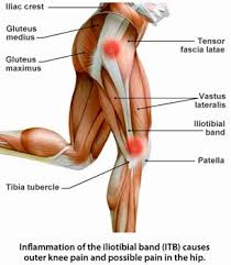 lateral knee pain itb friction