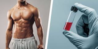 what are normal testosterone levels in men