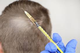 b12 deficiency hair loss enhance hair