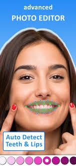 perfect smile teeth whitening on the