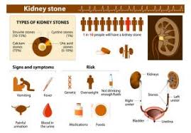 Indian Diet Plan For Kidney Stones Diet For Renal Calculi