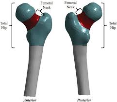 total hip and fem neck regions