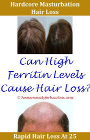 Formulas with selenium sulfide are more likely to cause hair loss (14). Hair Loss Dandruff Shampoo That Helps Hair Loss Dr Oz Inheritted Male Hair Loss Reasons For Sudden Rapid Hair Lo Hair Loss Men Help Hair Loss Hair Loss Reasons