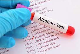 drink alcohol before a blood test