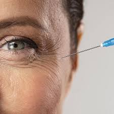 anti wrinkle injections for crow s feet