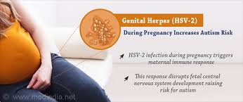 herpes infection during pregnancy