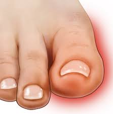 big toe pain what you need to know
