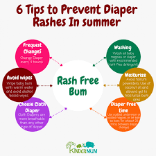 how to prevent rashes in es