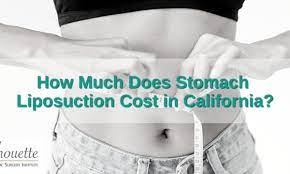 stomach liposuction cost in california