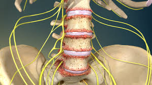 In the middle ages, the devil was. Back And Neck Pain Johns Hopkins Medicine