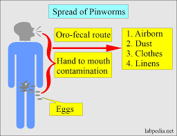 Enterobius Vermicularis Pinworms