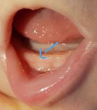 Wann kommt der erste zahn? Erster Zahn Forum Baby Urbia De