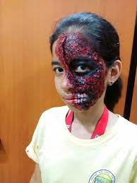 prosthetic makeup burnt face hive