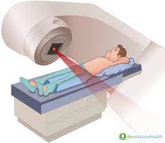Approximately 75 percent of men undergoing this treatment will experience hot flashes. Radiation Therapy For Prostate Cancer Ben S Natural Health