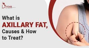 what is axillary fat causes how to