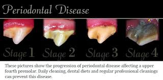 All Pets Dental Canine Dental Care Periodontal Disease