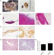slc41a3 mice develop hydronephrosis
