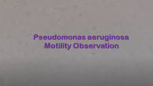 pseudomonas aeruginosa motility