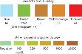 tests for detection of glucose in urine