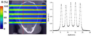 proton minibeam radiation therapy