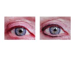 permanent makeup micropigmentation in