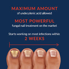 nail max anti fungal formula finger