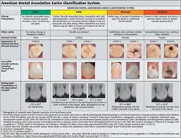 Dental Tooth Chart For Existing Dental Work Google Search