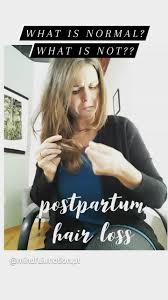 postpartum hair loss what is normal