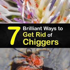 7 brilliant ways to get rid of chiggers