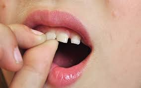Maybe you would like to learn more about one of these? Should I Pull Out My Child S Loose Tooth