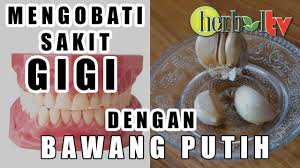 Cara mengobati sakit gigi dengan bawang putih. Obat Sakit Gigi Alami Menggunakan Bawang Putih Youtube