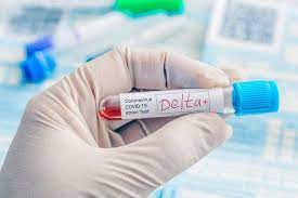 El grupo contagiado con la variante delta demostró tener hasta 1.260 veces más carga viral que aquellos que enfermaron con la primera versión del coronavirus. Gp5d 83ud Z4gm