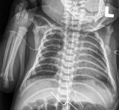 Fda Releases New Guidance On Childrens X Ray Exams
