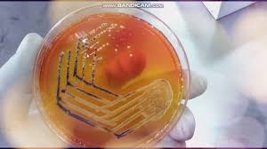 On the plate in xylose lysine deoxycholate agar (xld agar) is a selective growth medium, which is used for isolation of salmonella spp. Xylose Lysine Deoxycholate Agar Xld Selective Medium For Salmonella And Shigella Youtube