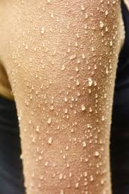 Condition of your skin when you are in a cold environment. 253 Goosebumps Fotos Kostenlose Und Royalty Free Stock Fotos Von Dreamstime