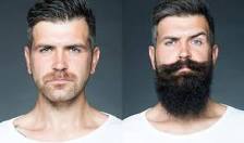 does-patchy-beard-mean-low-testosterone