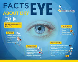 dry eyes symptoms causes treatment