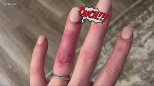 infection after nail salon visit it s