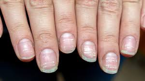 the truth about covid nails