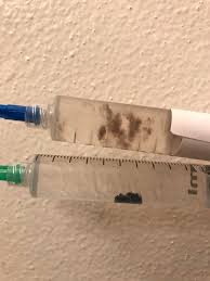 The syringe contains a solution of sterile water and hydrated mushroom spores collected from a mature mushroom. Is The Top Syringe Contaminated The Spores Look Like They Are Suspended In That Cloudy Mess Bottom Syringe Is For Reference Shrooms
