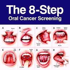 mouth cancer archives overland park